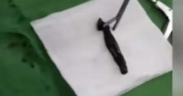 গলায় জোঁকের বাসা