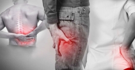 সায়াটিকার ব্যথা কমানোর ঘরোয়া উপায়