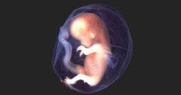 গর্ভ থেকে বের করে ভ্রূণের স্নায়ুতন্ত্রে অস্ত্রোপচার!