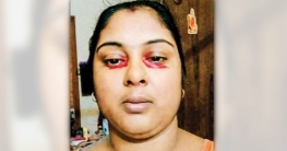 সন্ধ্যা নামলেই চোখে রক্তের ধারা