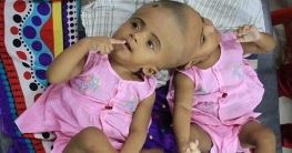 হাঙ্গেরিতে রাবেয়া-রোকাইয়ার প্রথম অপারেশন আজ