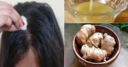 আদার রসে খুশকি দূর