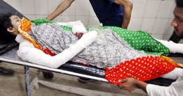 কান থুতনি গলা ঘাড় ঝলসানো ছিল নুসরাতের