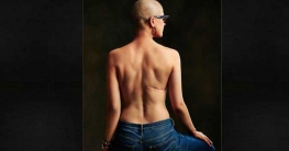 ক্যান্সার জয়ের কাহিনী