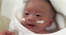 হাসপাতাল ছেড়েছে সবচেয়ে কম ওজনের শিশুটি