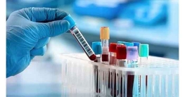 একই পরীক্ষায় রোগীর খরচ কোথাও ৬৫৭, কোথাও ১৩০০